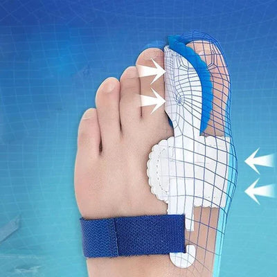Orthèse Ajustable pour Hallux Valgus