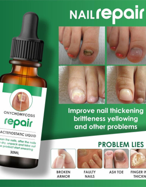 Nail Repair Serum Buy 1 Get 1 Free