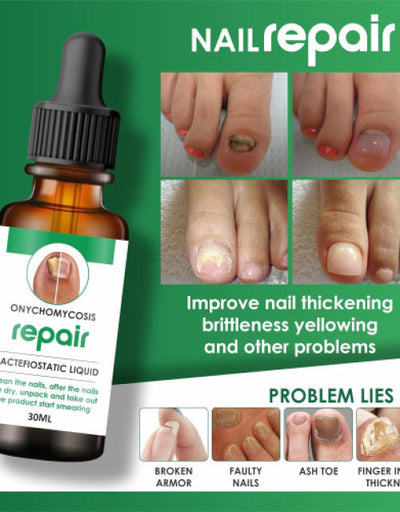Nail Repair Serum Buy 1 Get 1 Free